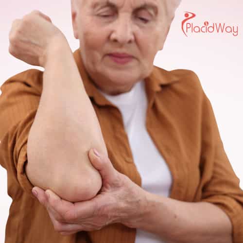 Osteoarthritis Treatment in Mexico: How Stem Cells Are Offering Hope in Guadalajara